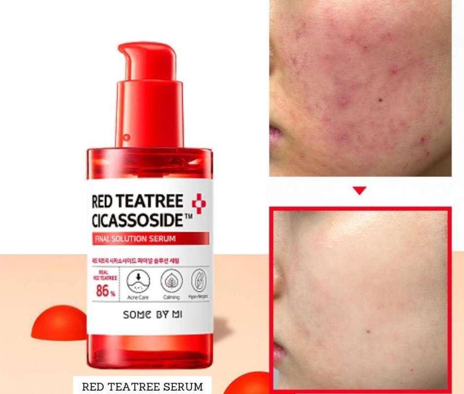 Red Tea Ree Tea Tree Some Bymi Gratis Ongkir 🔥 Harga Murah November 2025