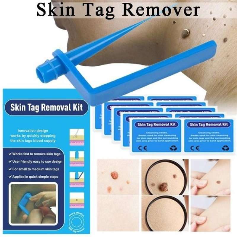 Remove kit. Remove kit. Remove kit. Набор для удаления имплантатов fixture remover kit. Stain removal.