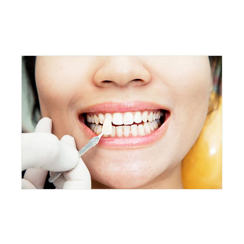 Jual MedikaApp Bleaching Gigi Klinik MHDC Klinik Medikids EVoucher di