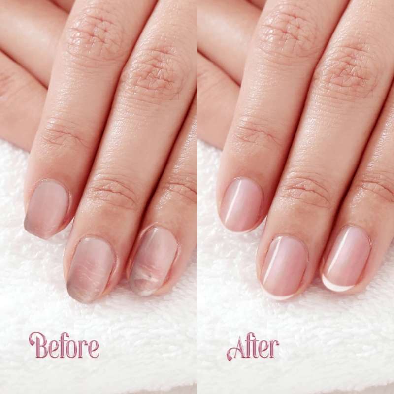 Jual Tone Nail Strengthening Protein Treatment Di Seller Beautiva ...