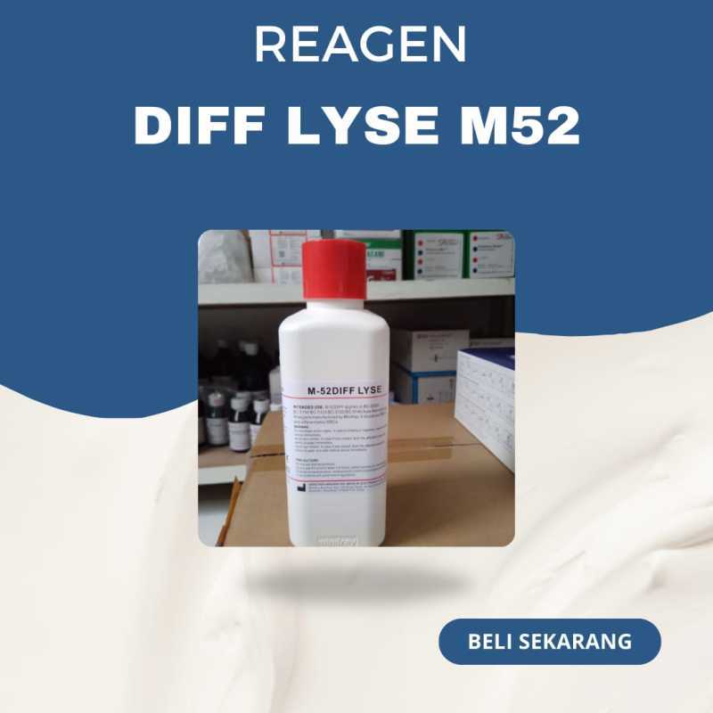 Lyse Ruchat Lyse Reagent Gratis Ongkir 🔥 Harga Murah Januari 2026