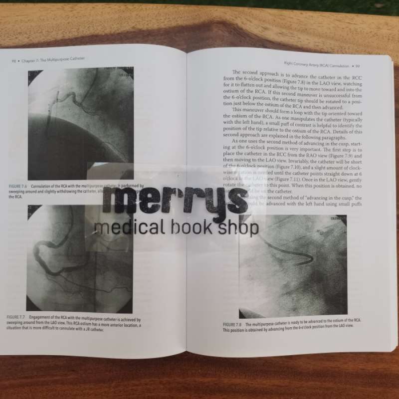 Promo [full Color /bw] Pocket Guide To Diagnostic Cardiac ...