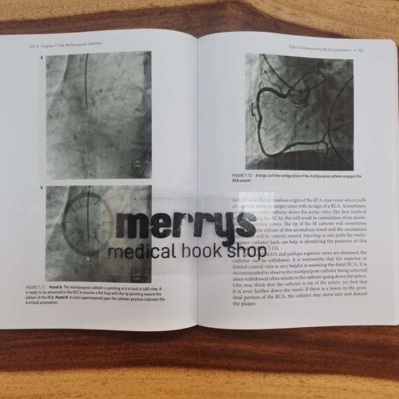Promo [full Color /bw] Pocket Guide To Diagnostic Cardiac ...