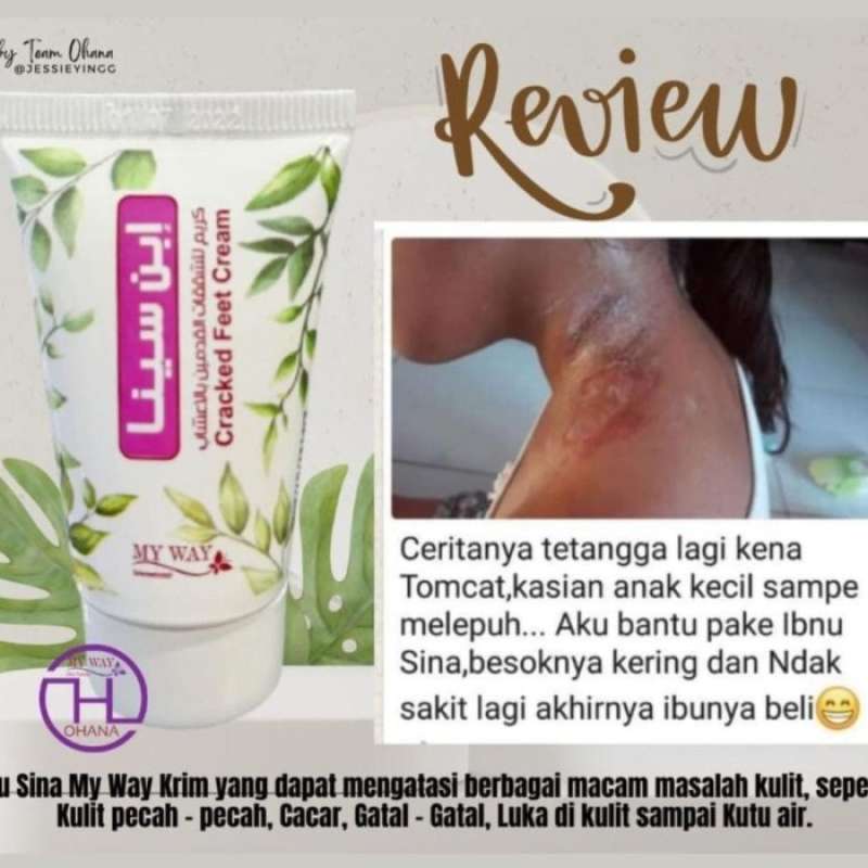 Jual Ibnu Sina My Way Obat Luka Dan Obat Kaki Pecah Pecah Di Seller Pro ...