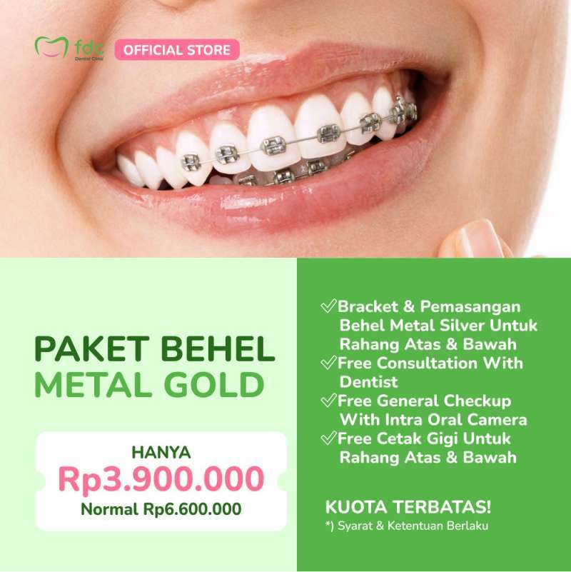 Promo FDC Dental Clinic Bandung Pemasangan Behel Gigi/Ortho/Kawat