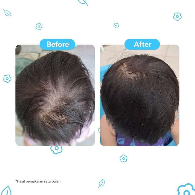 Jual Loluna 100ml Baby Hair Lotion Menyuburkan Rambut Dengan Wangi