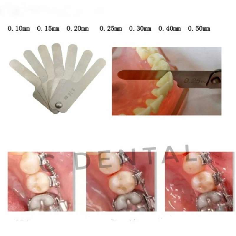 Promo Dental Ortho Interdental Proximal Space Gauge Gigi Set Diskon 23% ...