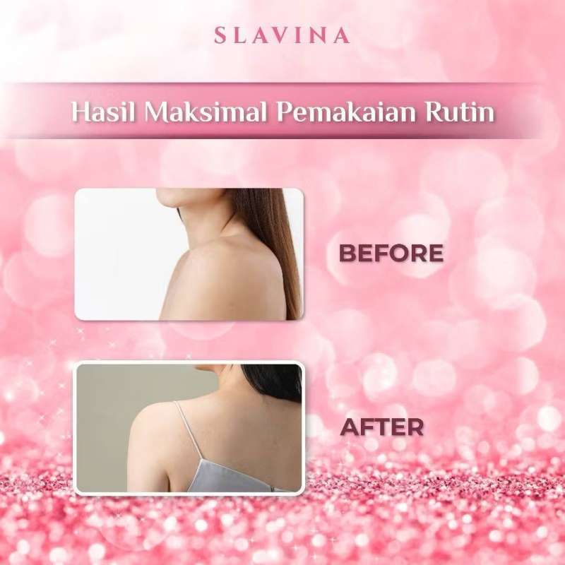 glutathione session cost WHITENING & BRIGHTENING INFUSION •⁠ ⁠brightening : hanya kandungan vit c  dan collagen cocok untuk mencerahkan kulit •⁠ ⁠⁠chromosome : bisa memutihkan  kulit dengan cepat hanya 2-3x •⁠ ⁠⁠usa : glutathione dosis main image 1