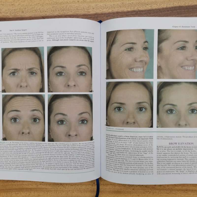 Jual Buku Kedokteran Grabb And Smith's Plastic Surgery 7e - Isi Hitam ...