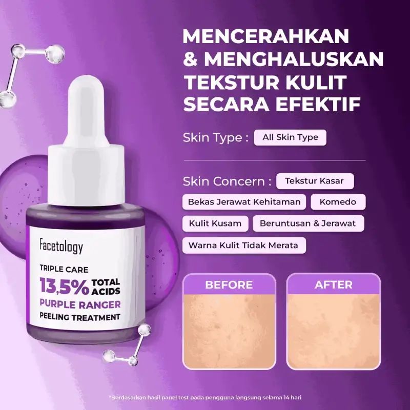 Promo [free Acne Calm Moist 10ml Pot] Facetology Bundling Triple Care ...