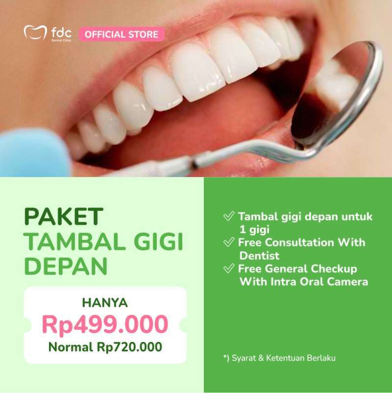 Jual Fdc Dental Clinic Bandung Tambal Gigi Depan/anterior Gigi Patah