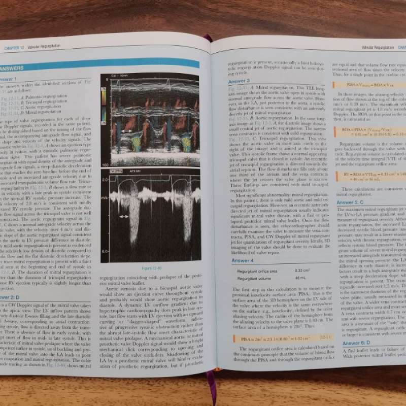Promo Buku Kedokteran Echocardiography Review Guide 3e Diskon 23% Di ...