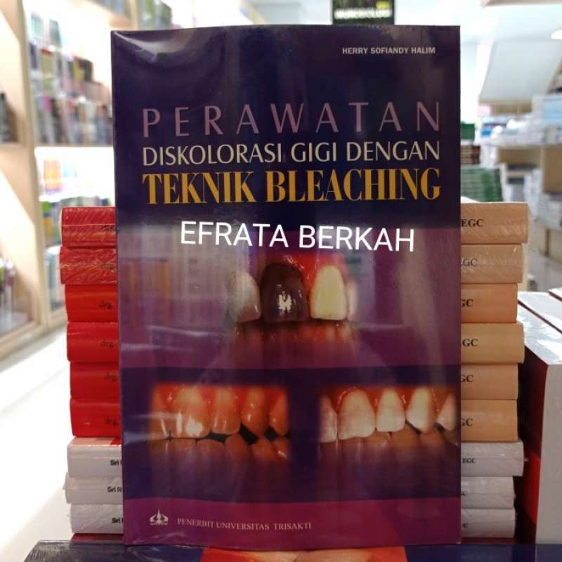 Promo perawatan diskolorasi gigi dengan teknik bleaching original