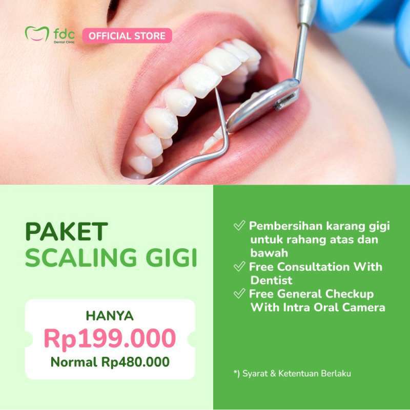 Promo FDC Dental Clinic Bandung Pembersihan Karang Gigi/Scaling Gigi