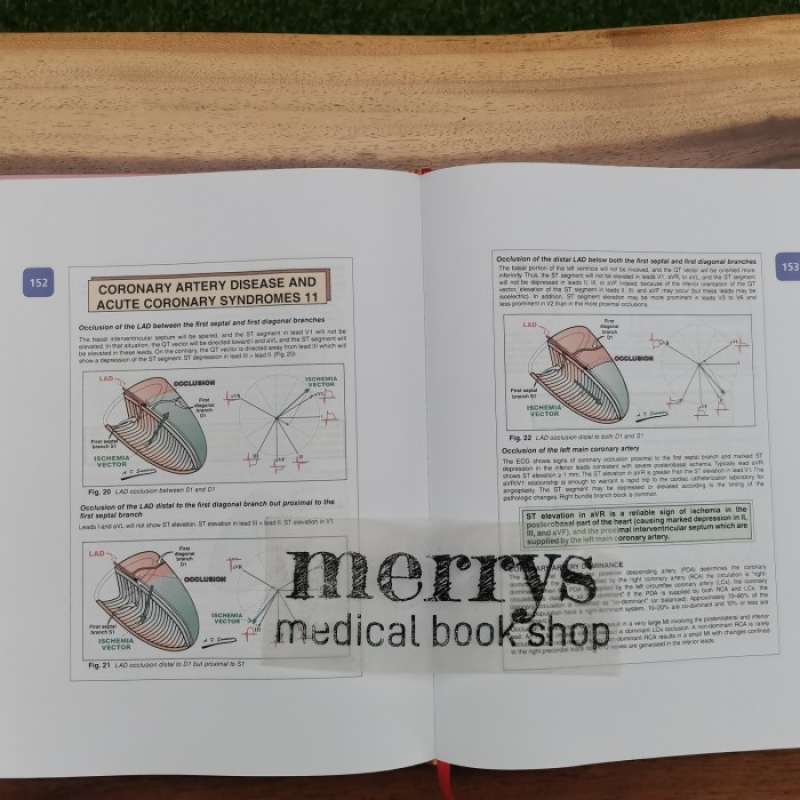Promo Buku Kedokteran Ecg From Basic To Essentials Step By Step Diskon ...