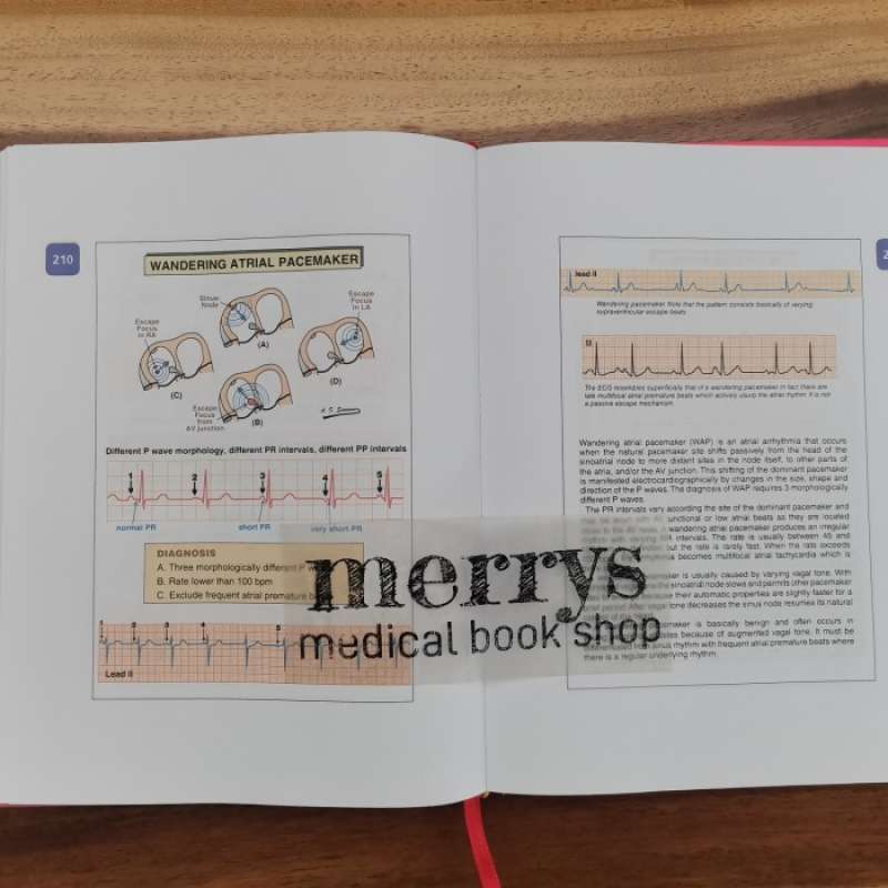 Promo Buku Kedokteran Ecg From Basic To Essentials Step By Step Diskon ...