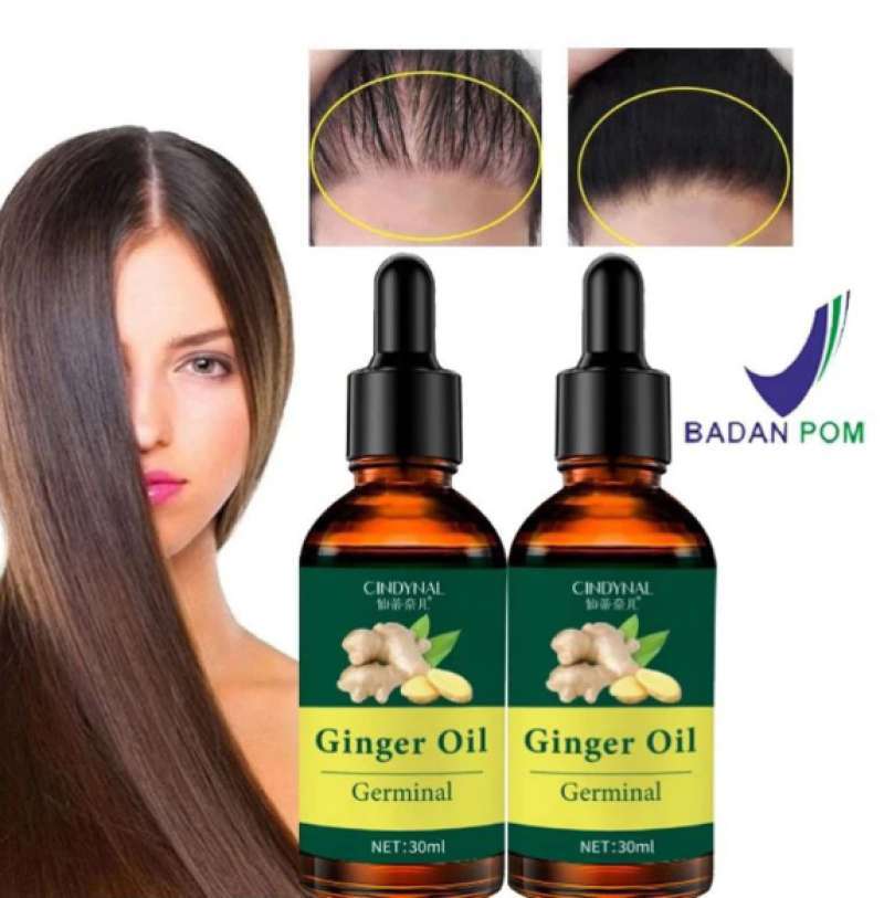 Jual Cindynal- Clothes Of Skin 7 Days Minyak Penumbuh Rambut Botak ...