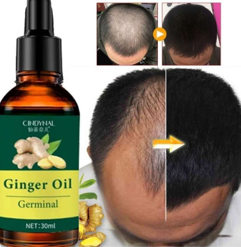 Jual Cindynal- Clothes Of Skin 7 Days Minyak Penumbuh Rambut Botak ...