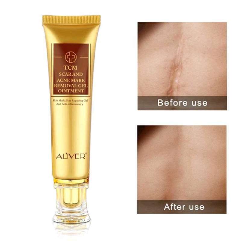 Jual Scar and Acne Mark Removal Gel Ointment Gel penghilang bekas luka