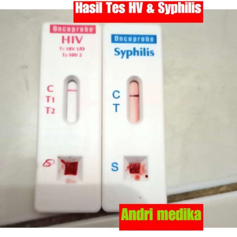 Promo Tes Syphilis Dan Tes Hiv Generasi 4 Isi 2 Tes Diskon 23 Di