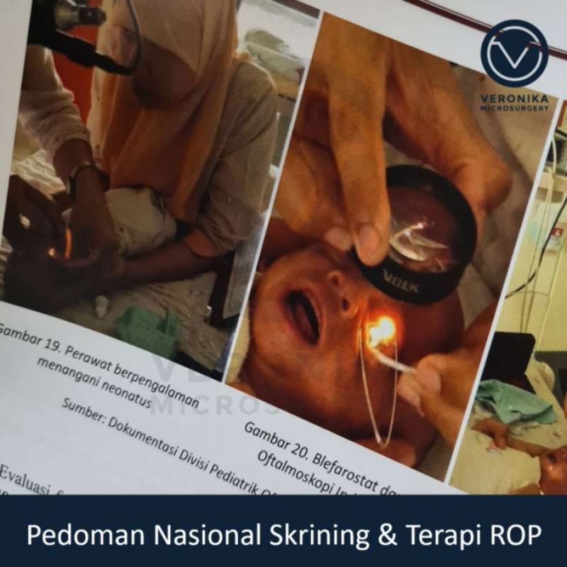 Promo Pedoman Nasional Skrining Dan Terapi Rop Retinopathy Of ...