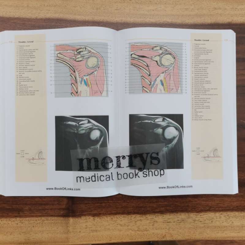 Promo Buku Kedokteran Atlas Of Sectional Anatomy The Musculoskeletal ...