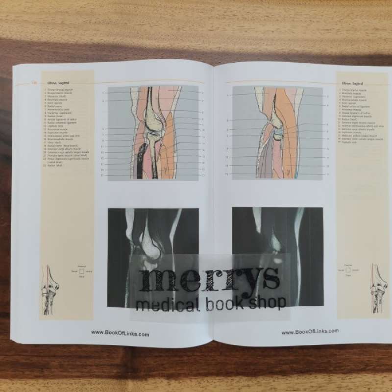Promo Buku Kedokteran Atlas Of Sectional Anatomy The Musculoskeletal ...