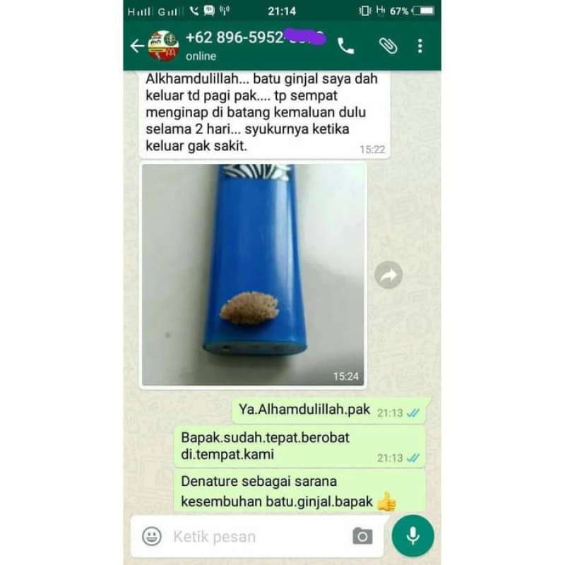 Jual Galgin Karomah - Peluruh Ampuh Batu Ginjal Dan Pereda Sakit ...
