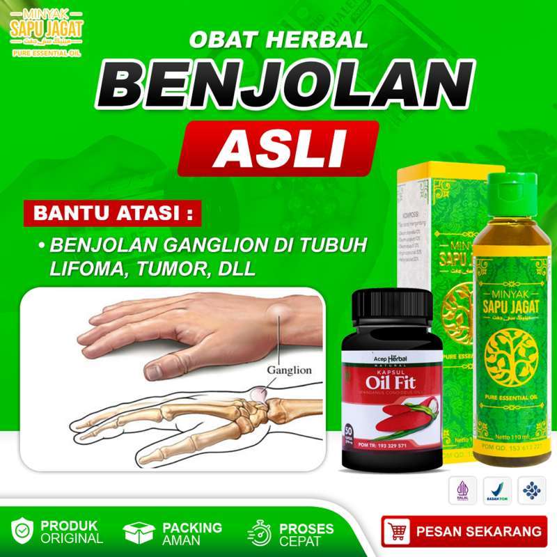 Promo Obat Oles Penghancur benjolan ganglion, Obat Benjolan Ganglion