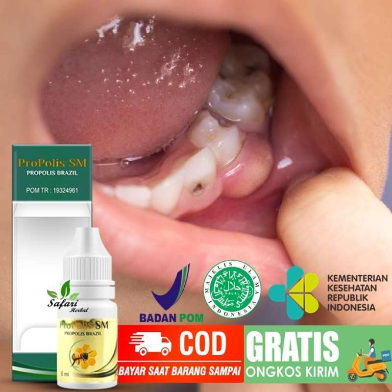 Promo Obat Tetes Gusi Bengkak, Sakit Gigi Berlubang, Pipi Bengkak Sakit