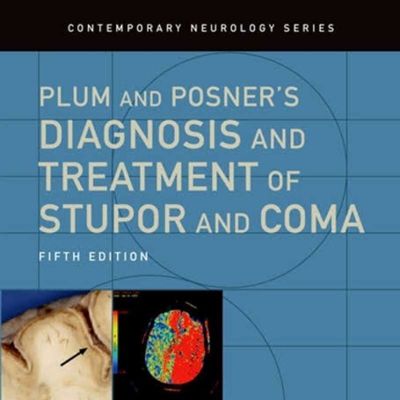 Promo Buku Kedokteran Plum And Posner Diagnosis Of Stupor And Coma
