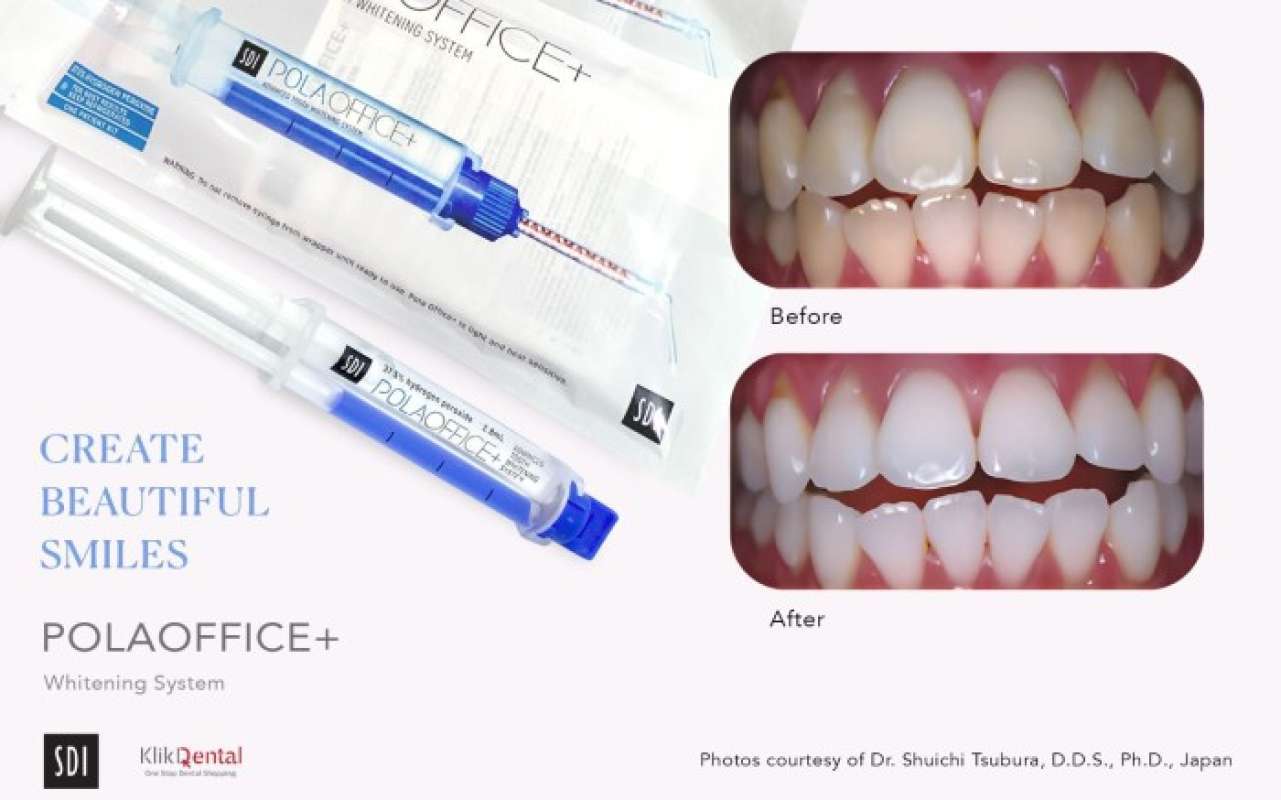 Jual Klik Dental Promo Pola Office Bleaching Gigi Gel Di Seller Suzuka