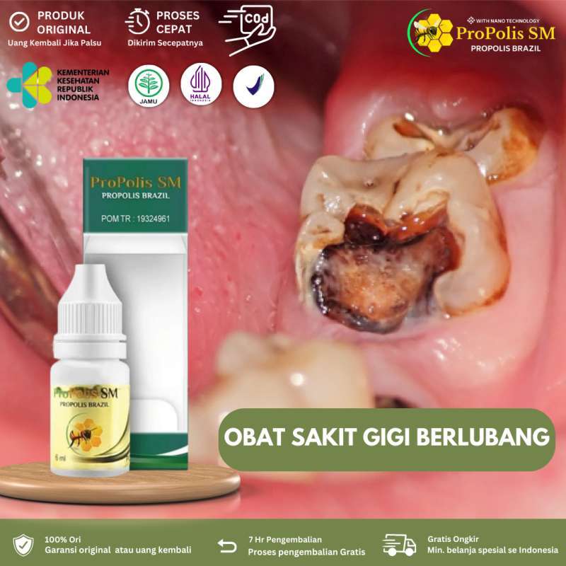 Jual Obat Sakit Gigi Berlubang Untuk Anak dan Dewasa Radang Gusi