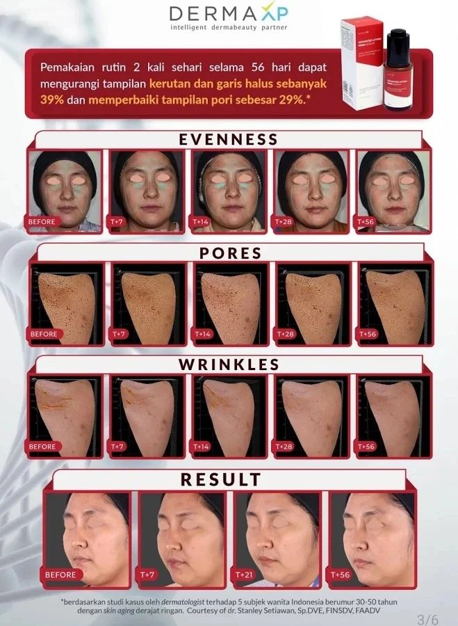 Jual Derma Xp Serum Advanced Lifting Pdrn 20ml - Salmon Dna & Serum ...