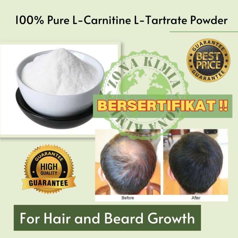 para que sirve la l carnitina inyectable La L-carnitina inyectada ayuda a: Quemar grasa Aumentar la energía y el  rendimiento físico Mejorar la recuperación muscular Favorecer la salud  cardiovascular Acelerar el metabolismo Aumentar la vitalidad Tener mejor  absorción que