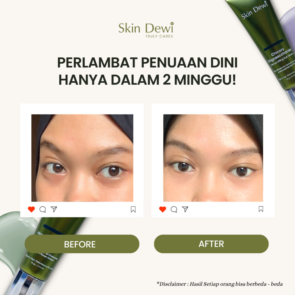 Promo Skin Dewi Chicoryoligosaccha Ride Intense Lifting Eye Serum