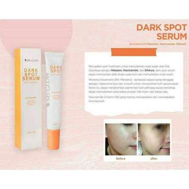 DARK SPOT SERUM MS GLOW/ MS GLOW DARK SPOT SERUM