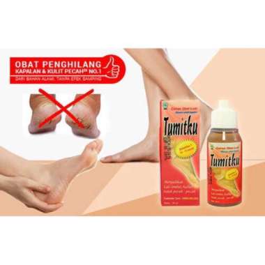 Tumitku Mengatasi Kaki Pecah - Kapalan - Tumitku Kapalan