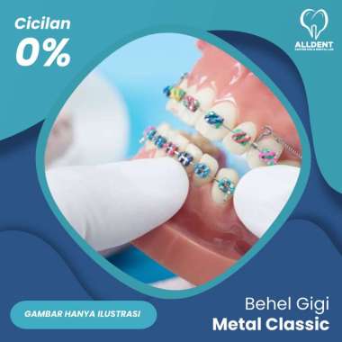 Behel Gigi Metal Classic