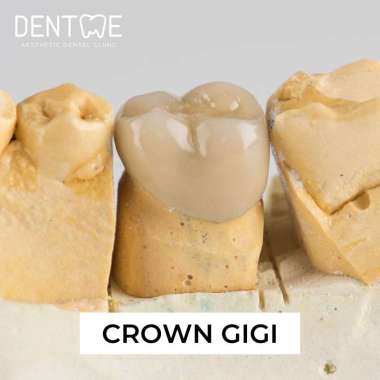 Crown Gigi / Mahkota Gigi