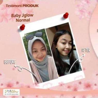 jglow skincare ori j glow paket baby normal skin whitening cream bpom penghilang jerawat set perawat