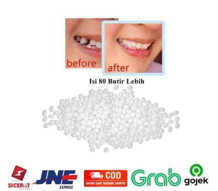 Temporary Tooth Repair Kit - Denture Adhesive Glue / Lem Gigi Palsu