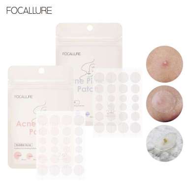 Focallure Acne Pimple Patch Day