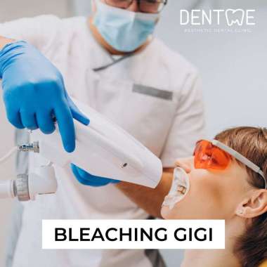 Bleaching Gigi/ Pemutihan Gigi