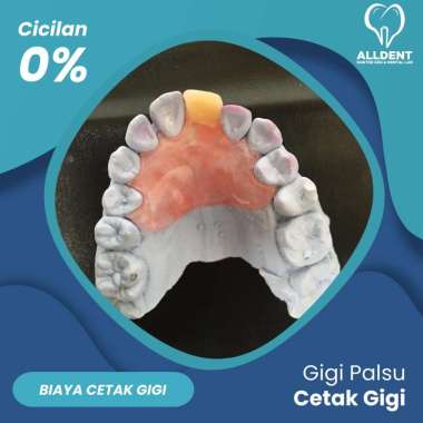 Cetak Gigi Alginate - 2 Rahang