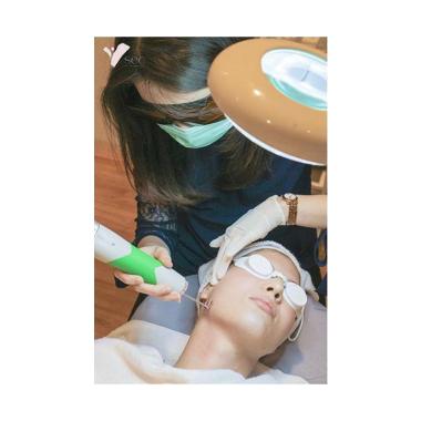 SEC CLINIC Laser ND-YAG Perawatan Wajah - -