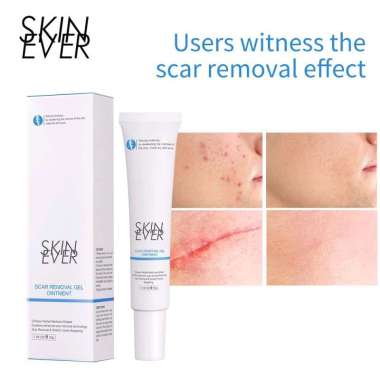 Skin Ever Scar Removal Gel Skin Ever Scar Removal Gel reduces acne