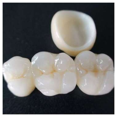 Crown Porcelain Zirconia