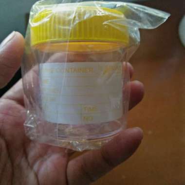 URINE POT