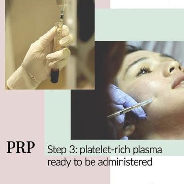 SEC CLINIC PRP Treatment E-Voucher - -